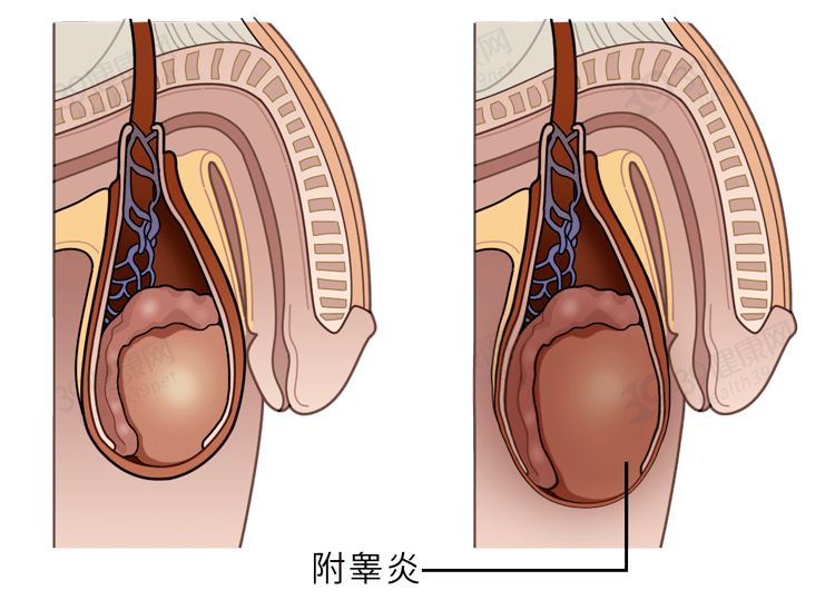 男性阴囊干燥起皮削，原因解析与应对之策