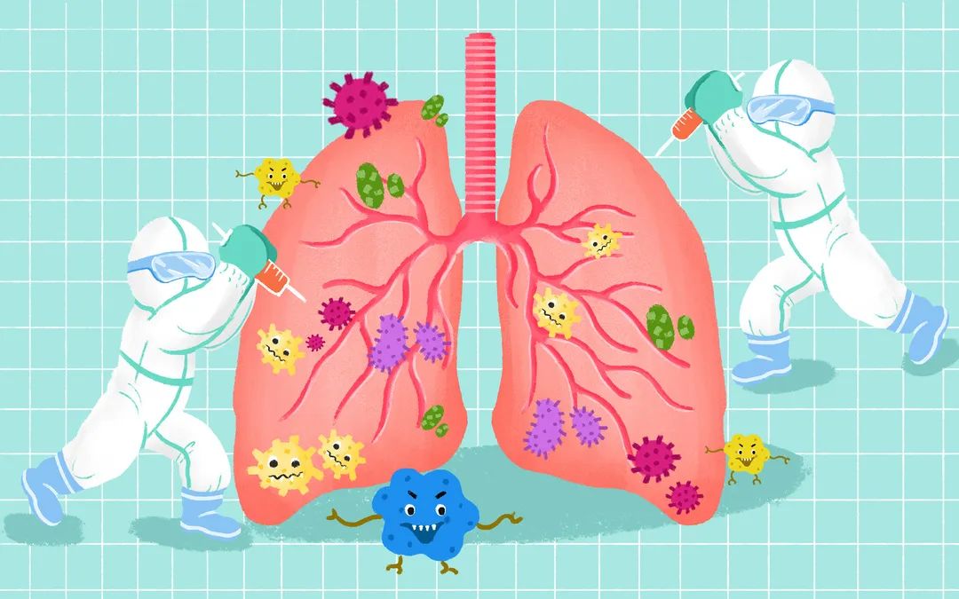 肺炎，全面解析了解、预防与治疗策略