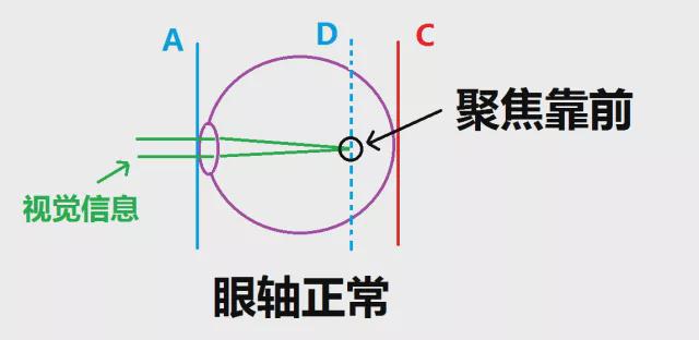 揭秘，北大医生推荐迎日闭眼预防近视法，原理何在？