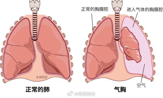 爆肺概念解析